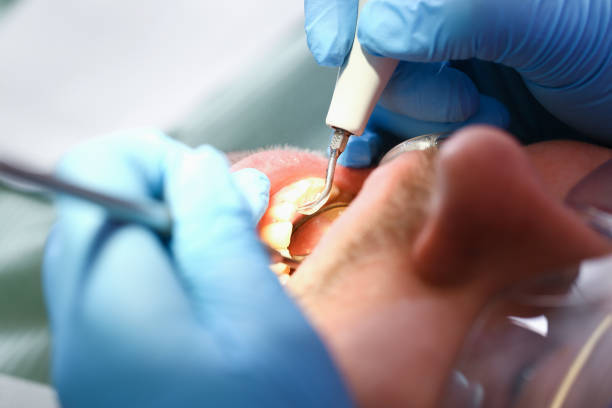 Professional Emergency Dentist in MO